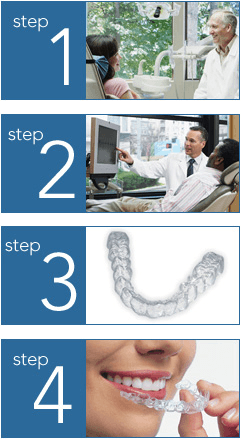 Invisalign